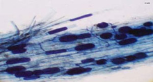 Microscopic view of an endotrophic mycorrhiza infecting a plant root.